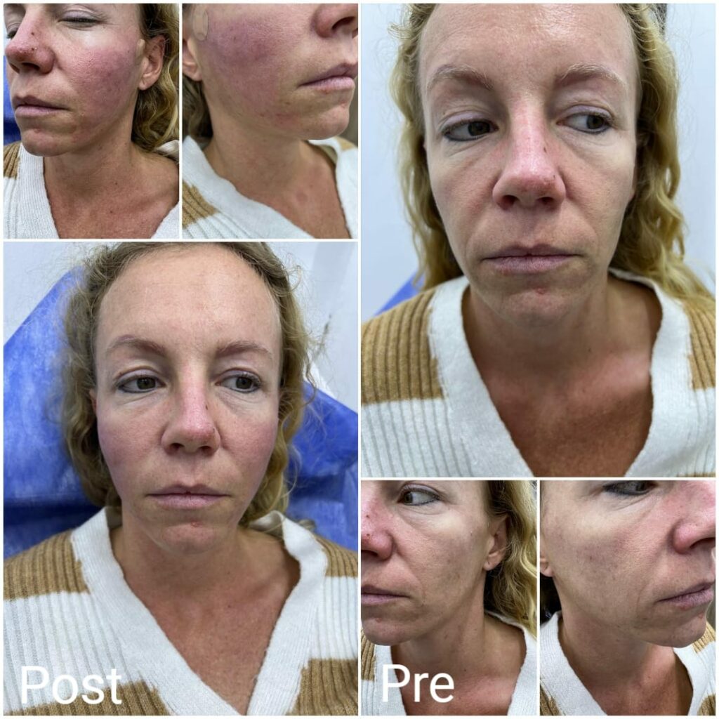 The best plastic surgeon in Hurghada